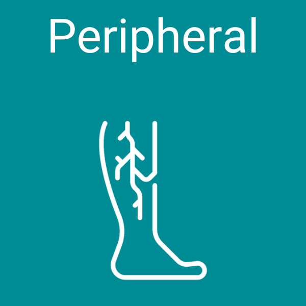 Peripheral